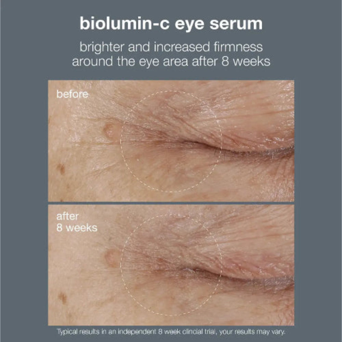  Klinisk bevist: Dermalogica BioLumin-C Eye Serum gir lysere og fastere hud rundt øynene etter 8 ukers daglig bruk – uavhengig klinisk test
