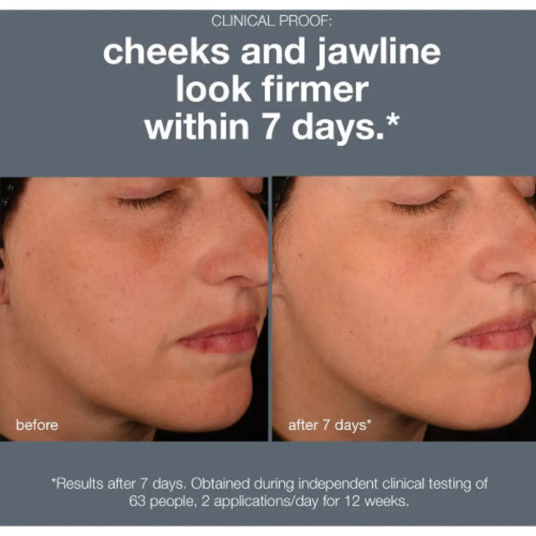 Klinisk bevist: Dermalogica Pro Collagen Banking Serum gir fastere kinn og kjevelinje innen 7 dager – uavhengig klinisk test med 63 deltakere