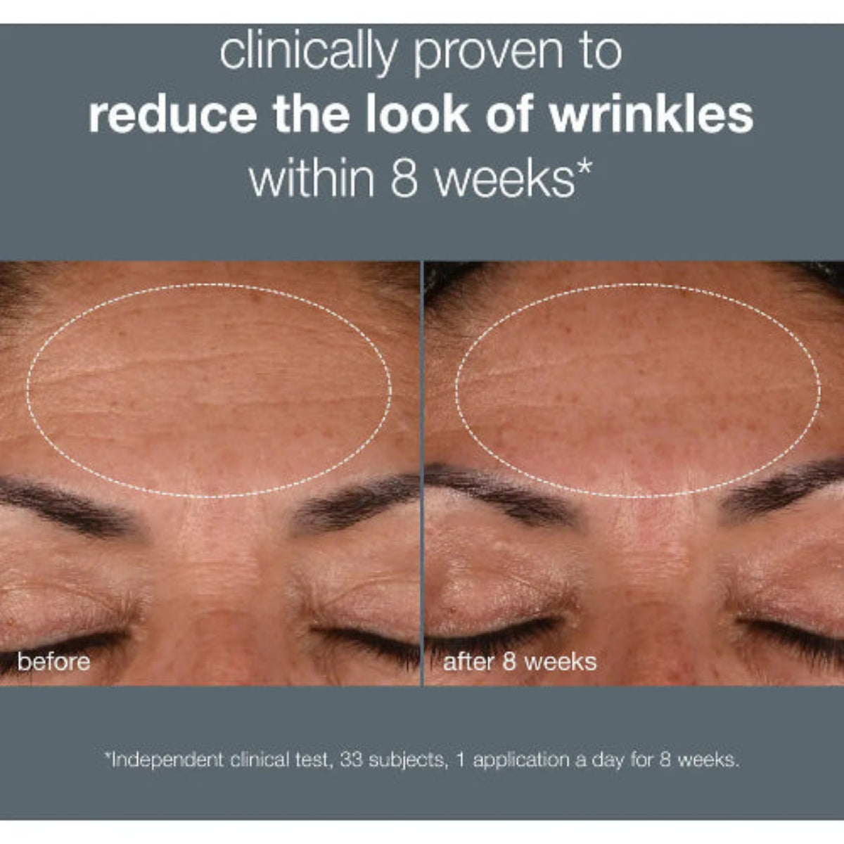 Klinisk bevist: Dermalogica Dynamic Skin Recovery SPF50 reduserer synligheten av rynker etter 8 ukers daglig bruk – uavhengig klinisk test med 33 deltakere